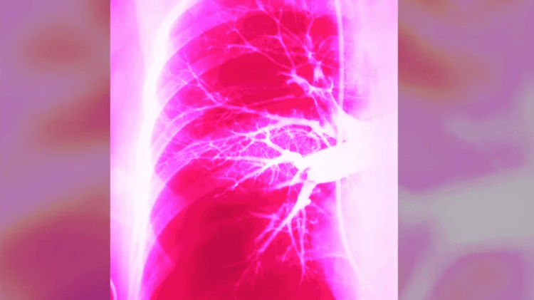 triệu chứng khó thở hụt hơi