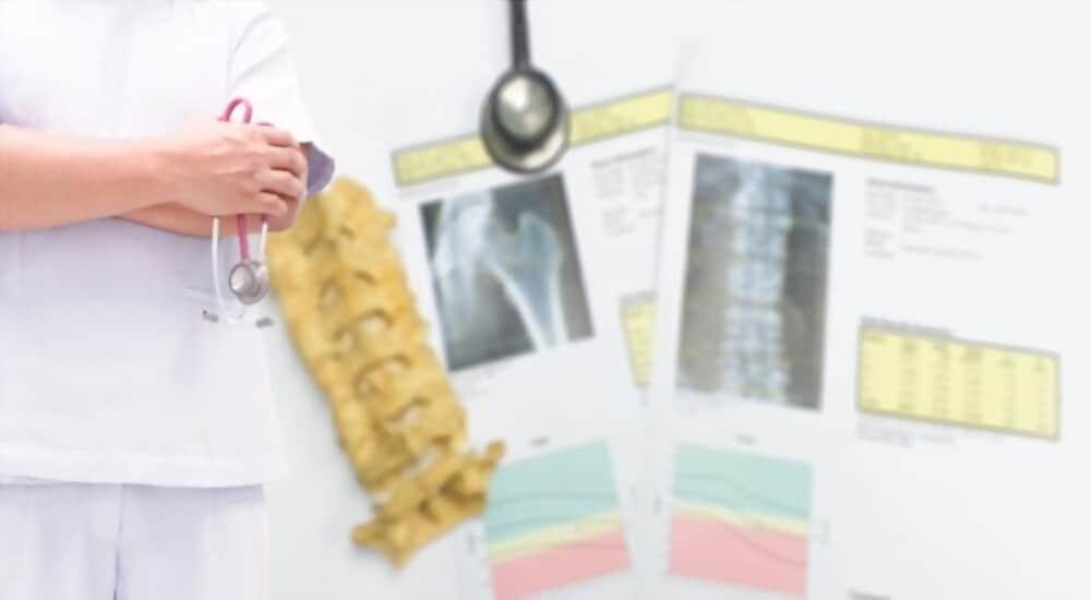 kết quả đo mật độ xương