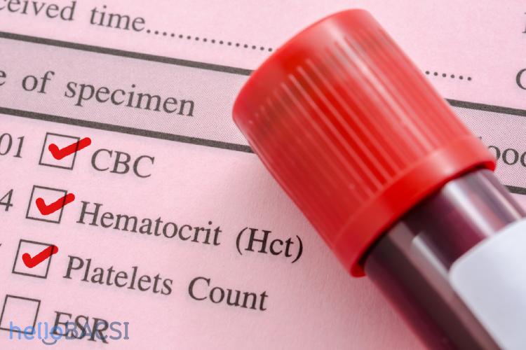 xét nghiệm công thức máu