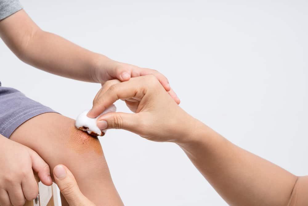 cách dùng thuốc povidine