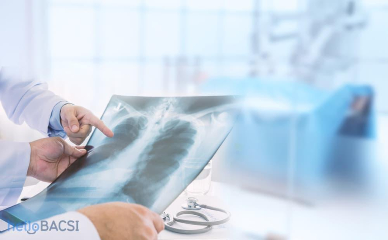 tăng áp động mạch phổi 1