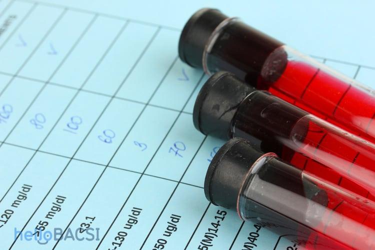 xét nghiệm máu tổng quát