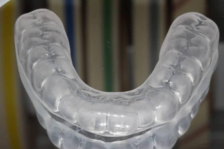 bảo vệ răng miệng