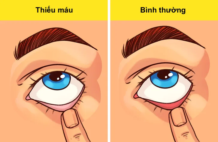 cách kiểm tra sức khỏe