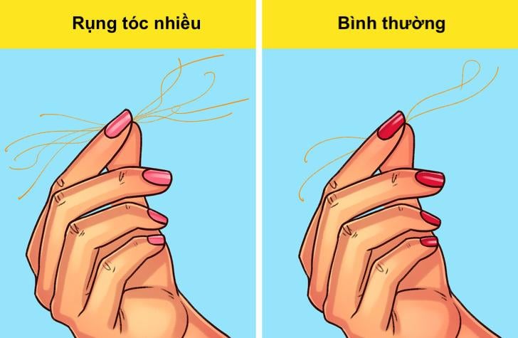 cách kiểm tra sức khỏe