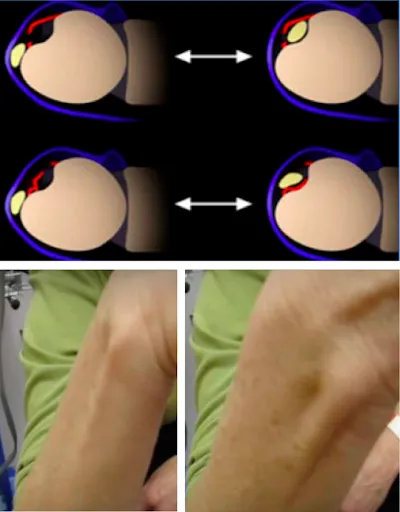 đau cổ tay bên trụ