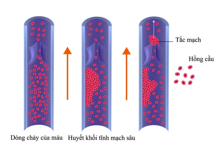 Mát xa chân: Bí quyết giúp bà bầu thoát khỏi chứng phù nề