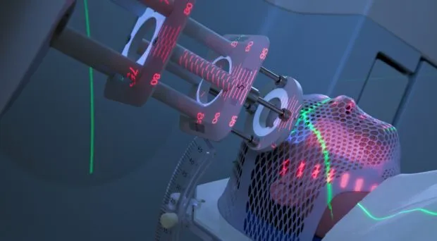 điều trị ung thư di căn lên não