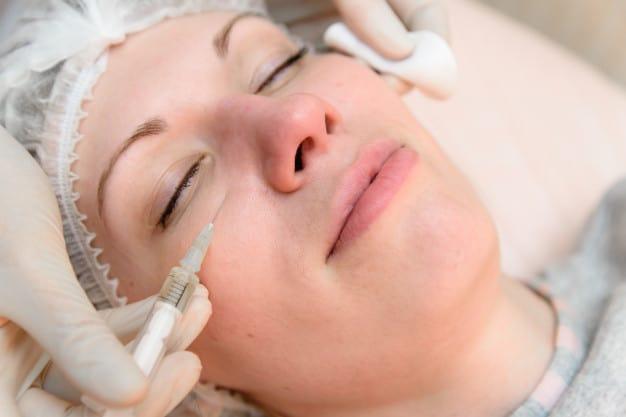 xóa nếp nhăn vùng mắt