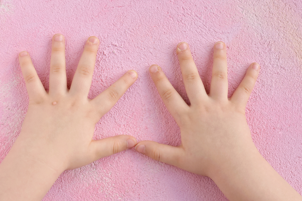 bệnh sùi mào gà ở trẻ em