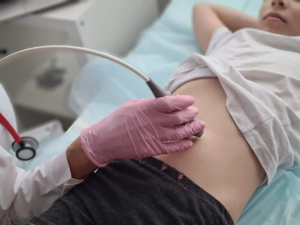 chẩn đoán đau bụng quanh rốn ở trẻ em