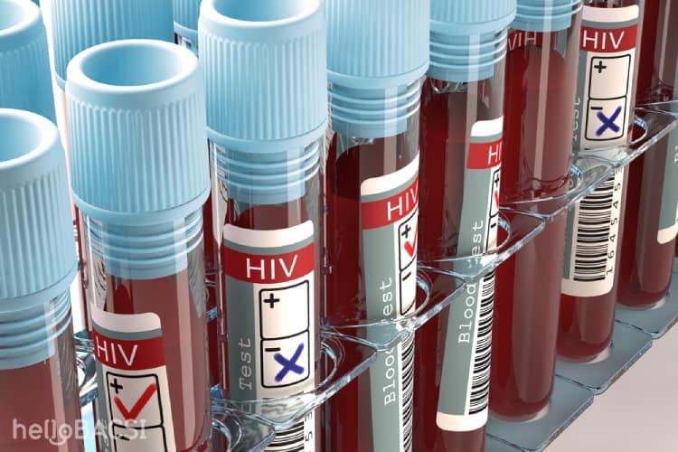 kết quả xét nghiệm hiv