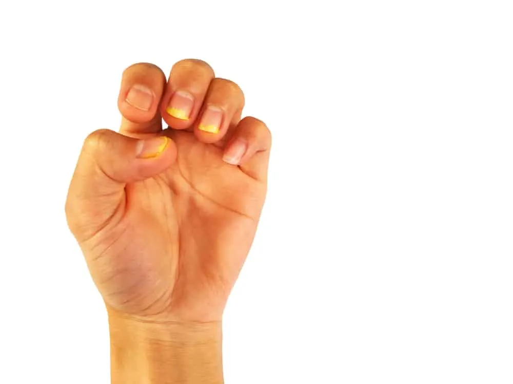 Móng tay màu vàng biểu hiện sức khỏe