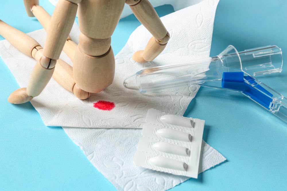 chảy máu trực tràng