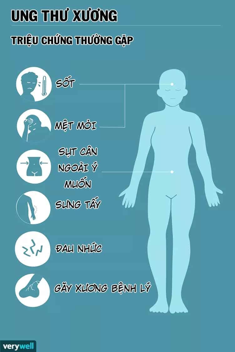 Dấu hiệu ung thư xương 0