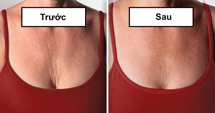 Cách giảm nếp nhăn ở ngực: giảm nếp nhăn ở ngực