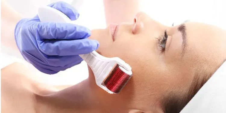 lăn kim siêu vi điểm