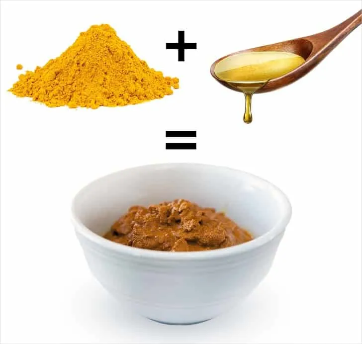 Móng chân mọc ngược