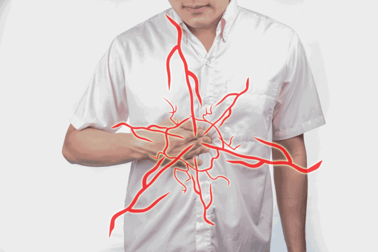 nguyên nhân đau thượng vị: Viêm thực quản