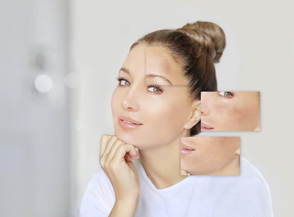 chăm sóc da bà bầu bị nám