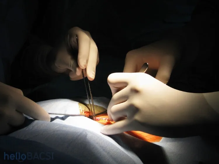 Phương pháp ghép gan