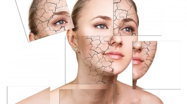 tác dụng của sữa ong chúa với da mặt