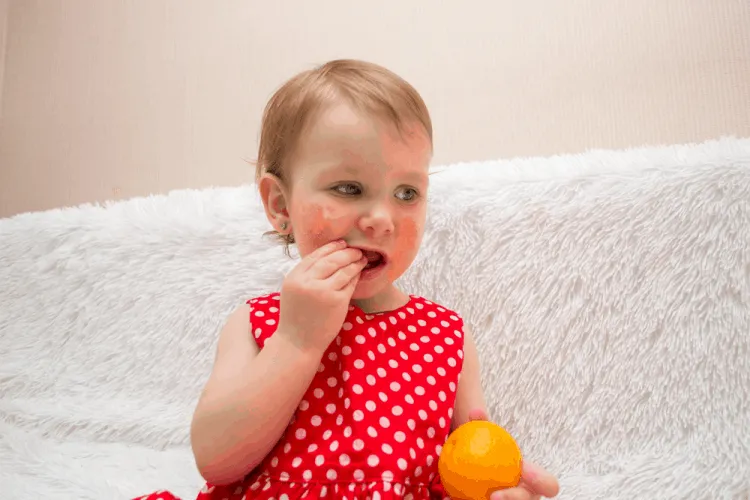 Nguyên nhân gây dị ứng amoxicillin