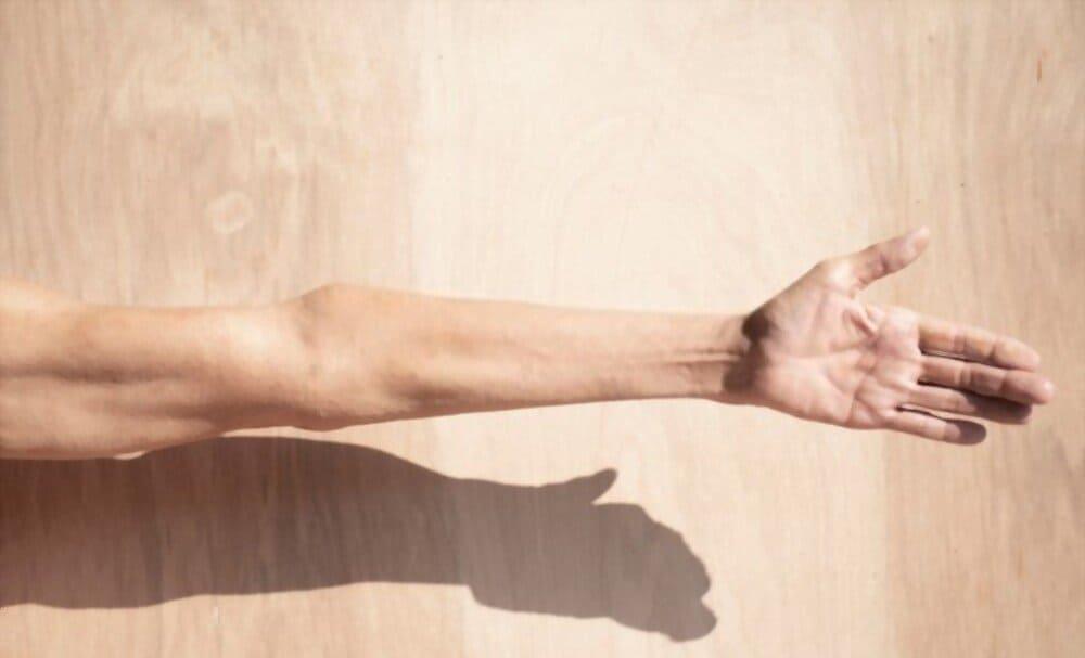 dấu hiệu teo cơ