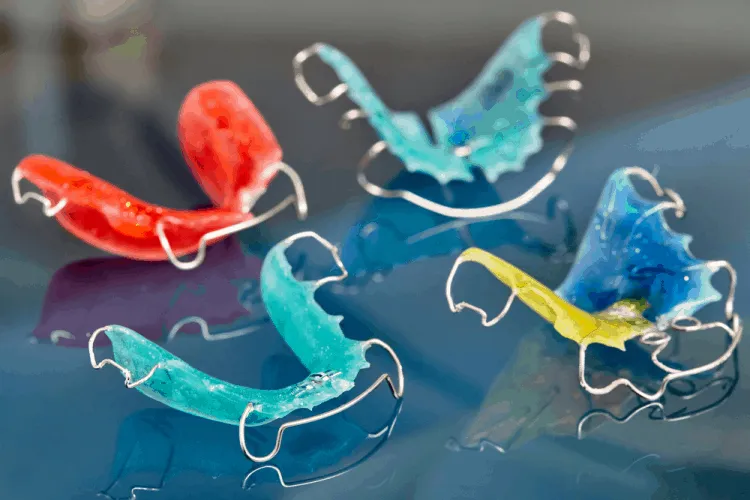 Đeo hàm duy trì sau khi niềng răng