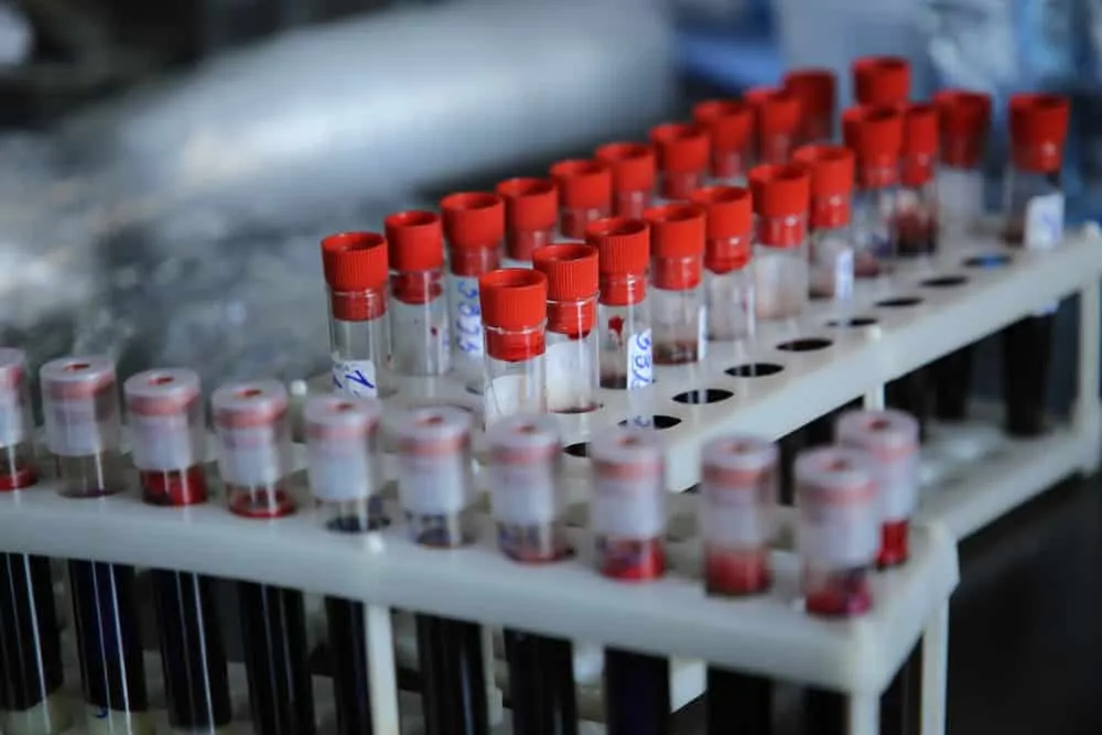 Các loại ung thư máu