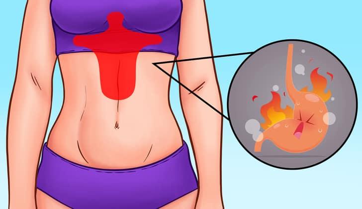 vị trí đau bụng 3