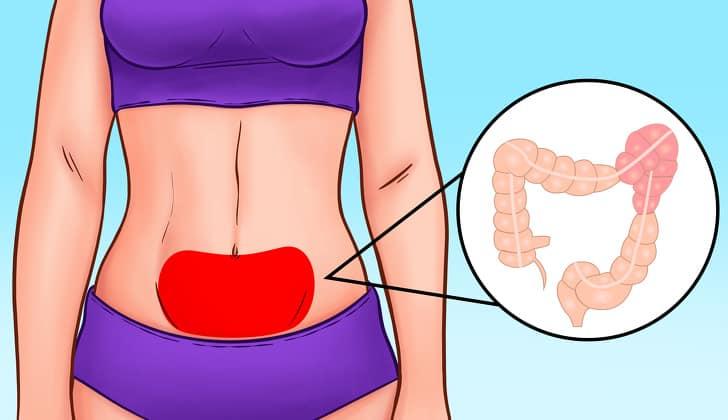 vị trí đau bụng 5