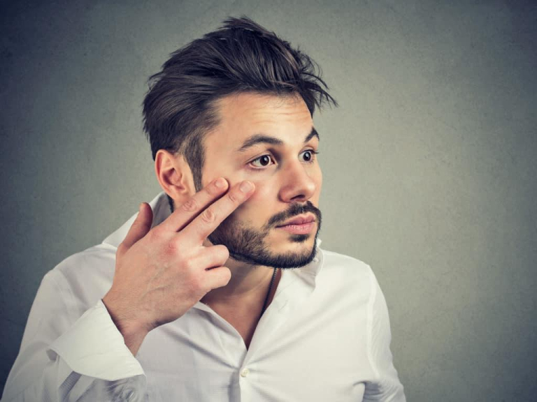 Viêm gan siêu vi b 1