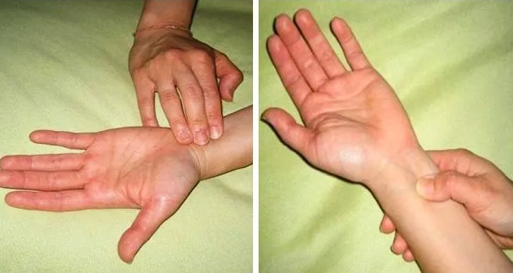 cách xử lý khi bị chóng mặt bằng bấm huyệt cổ tay