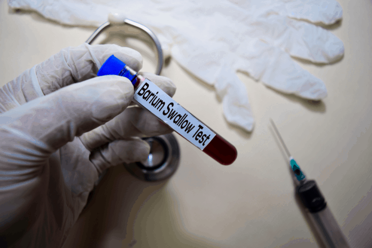 chẩn đoán trào ngược dạ dày