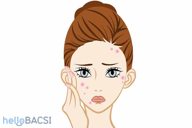 Toner phù hợp với làn da dầu mụn