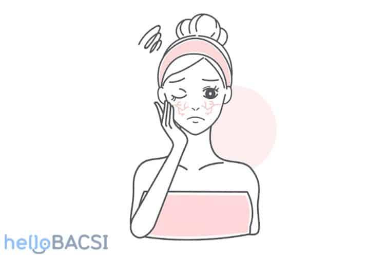 lợi ích kem dưỡng ẩm ngăn ngừa khô da