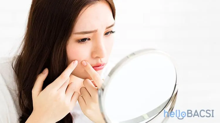 nặn mụn chưa chín