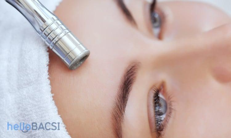 Mài mòn da trị sẹo mụn