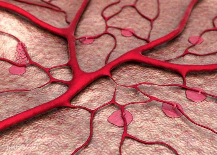 nguyên nhân bệnh võng mạc tiểu đường