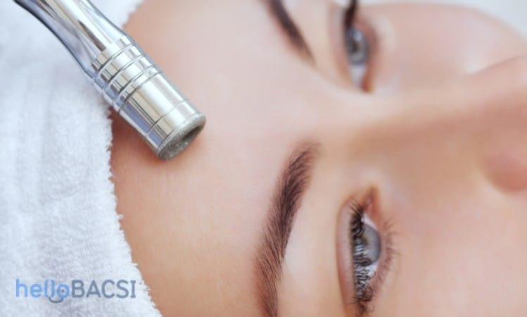 Microdermabrasion – kỹ thuật siêu mài mòn da