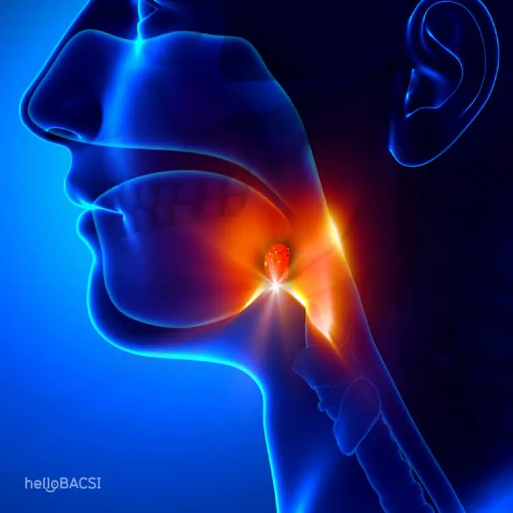 viêm amidan có lây không