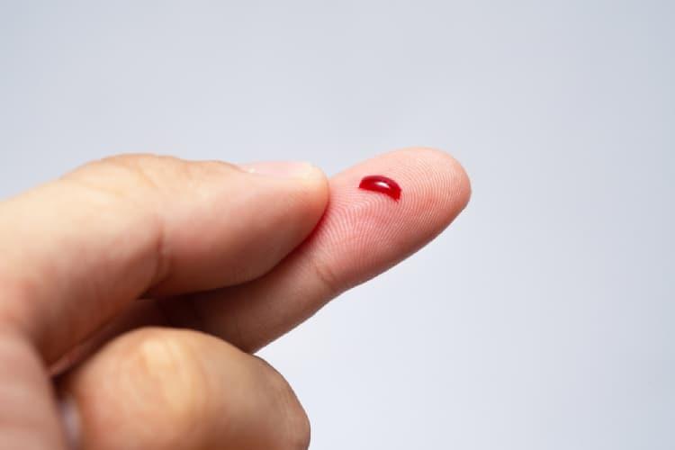 bệnh giảm tiểu cầu có chữa được không