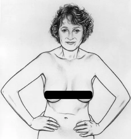 cách kiểm tra ung thư vú qua dáng ngực