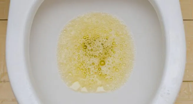 dấu hiệu bệnh thận 