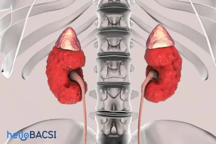 dấu hiệu bệnh thận 