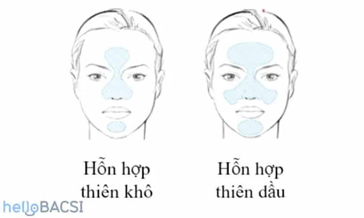 phân biệt da hỗn hợp