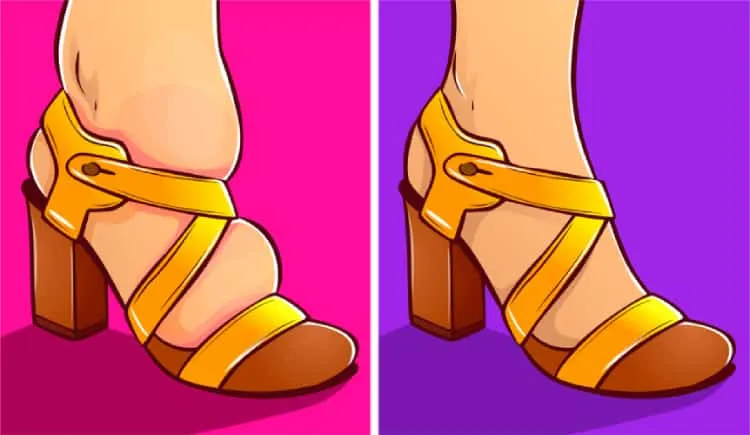 phù bàn chân do suy tim