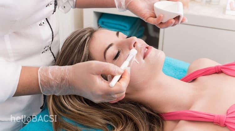 Trị sẹo bằng mặt nạ hóa học