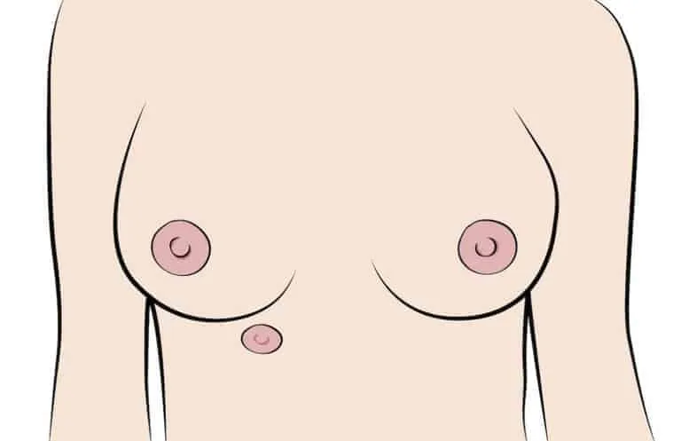 Đầu nhũ hoa ở mỗi người là khác nhau